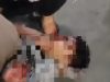 Pedagang Jasuke Jadi Korban Geng Motor di Tasikmalaya, Kini di Tangani Polisi !